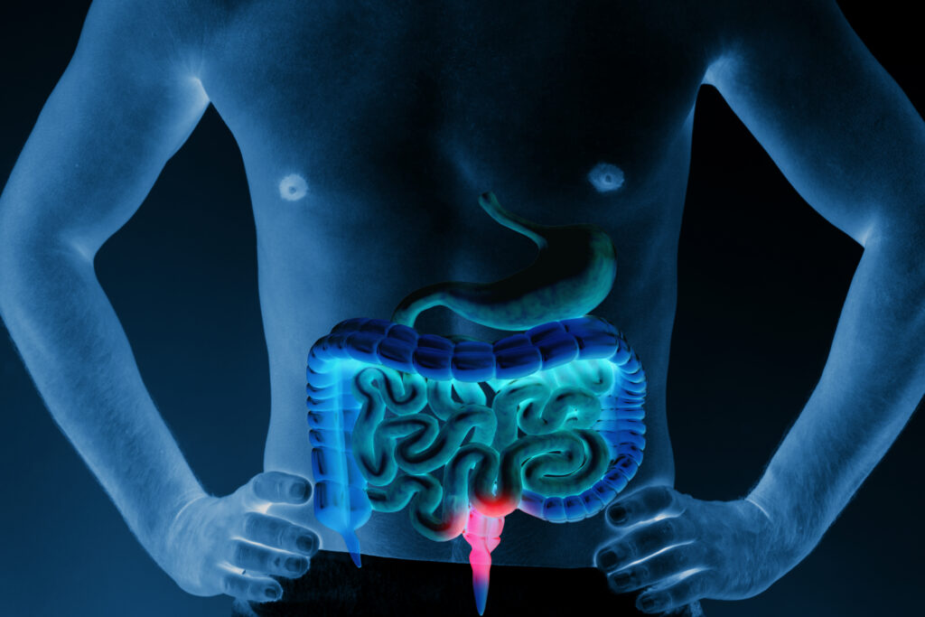 O que é diarréia e gastroenterite?